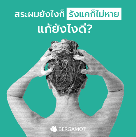 สระผมยังไงก็รังแคก็ไม่หาย แก้ยังไงดี? - Bergamot